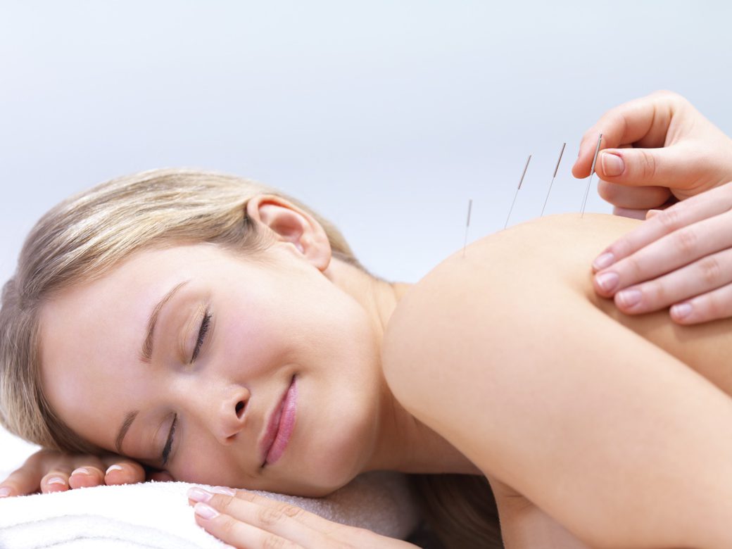 Acupuncture Treatment Norwich